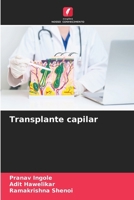 Transplante capilar (Portuguese Edition) 6208734215 Book Cover