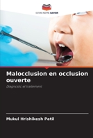 Malocclusion en occlusion ouverte: Diagnostic et traitement (French Edition) B0CJXMBDHF Book Cover