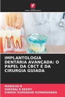 Implantologia Dentária Avançada: O Papel Da Cbct E Da Cirurgia Guiada (Portuguese Edition) 663021594X Book Cover