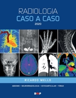 Radiologia Caso a Caso 2020 8566986032 Book Cover