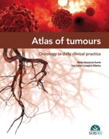 Atlas of tumours. Oncology in daily clinical practice 8416315264 Book Cover
