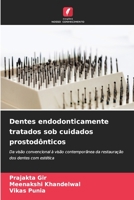 Dentes endodonticamente tratados sob cuidados prostodônticos 6205779919 Book Cover