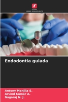 Endodontia guiada (Portuguese Edition) 6208294827 Book Cover