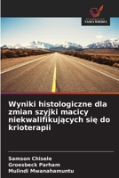 Wyniki histologiczne dla zmian szyjki macicy niekwalifikujacych sie do krioterapii 6209111866 Book Cover