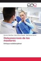 Osteonecrosis de los maxilares 6202233974 Book Cover
