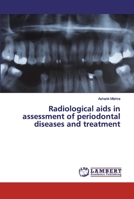 Radiological aids in assessment of periodontal diseases and treatment 613986335X Book Cover