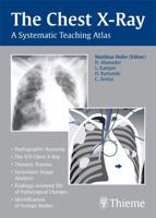 Chest X-ray Trainer 3131442115 Book Cover