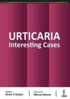 Urticaria: Interesting Cases 9389587492 Book Cover