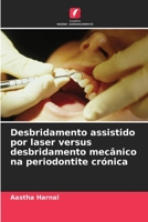 Desbridamento assistido por laser versus desbridamento mec?nico na periodontite cr?nica 6205375699 Book Cover