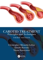 Carotid Treatment : Principles and Techniques 1032047704 Book Cover