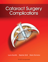 Cataract Surgery Complications 1617116084 Book Cover