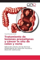 Tratamiento de lesiones premalignas y cáncer in situ de colon y recto 6202155167 Book Cover