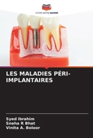 Les Maladies Péri-Implantaires 6207339622 Book Cover