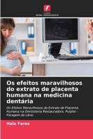 Os efeitos maravilhosos do extrato de placenta humana na medicina dentária (Portuguese Edition) 6206923355 Book Cover