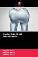 Biocerâmica na Endodontia 6203165883 Book Cover