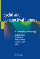 Eyelid and Conjunctival Tumors: In Vivo Confocal Microscopy 3030366057 Book Cover