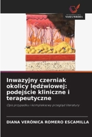Inwazyjny czerniak okolicy ledzwiowej: podejscie kliniczne i terapeutyczne (Polish Edition) 6630138643 Book Cover