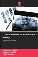 O osso alveolar na saúde e na doença (Portuguese Edition) 6209473067 Book Cover