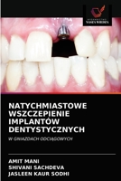 Natychmiastowe Wszczepienie Implantów Dentystycznych 620321650X Book Cover