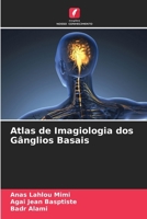 Atlas de Imagiologia dos Gânglios Basais (Portuguese Edition) 6208018110 Book Cover
