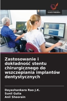 Zastosowanie i dokladnosc stentu chirurgicznego do wszczepiania implantów dentystycznych (Polish Edition) 6208687454 Book Cover