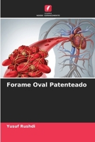 Forame Oval Patenteado (Portuguese Edition) 6208238595 Book Cover