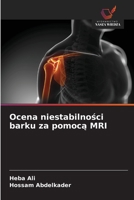 Ocena niestabilnosci barku za pomoca MRI (Polish Edition) 6207829778 Book Cover