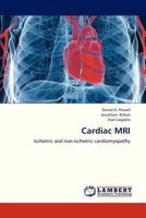 Cardiac MRI 3659325864 Book Cover