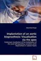 Implantation of an aortic bioprosthesis: Visualisation via the apex: Endoscopic visualisation of the implantation of this novel self-expanding, sutureless aortic bioprosthesis in cadaver hearts 3639296125 Book Cover