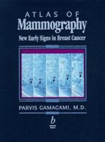 Atlas of Mammography: New Early Signs in Breast Cancer 0865424810 Book Cover