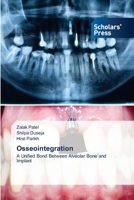 Osseointegration: A Unified Bond Between Alveolar Bone and Implant 6138969634 Book Cover