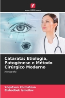 Catarata: Etiologia, Patogénese e Método Cirúrgico Moderno (Portuguese Edition) 6208548594 Book Cover