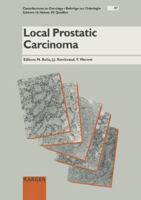 Local Prostatic Carcinoma 3805559739 Book Cover