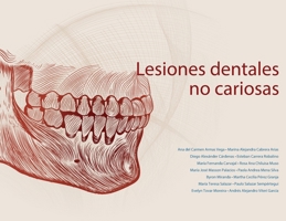 Lesiones dentales no cariosas (Spanish Edition) 9978389474 Book Cover