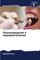 Пьезохирургия в пародонтологии 6206057569 Book Cover