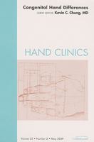 Congenital Hand Differences, An Issue of Hand Clinics (The Clinics: Orthopedics) 1437704832 Book Cover