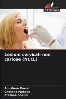 Lesioni cervicali non cariose (NCCL) (Italian Edition) 6209822045 Book Cover