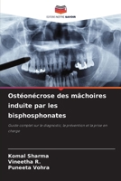 Ostéonécrose des mâchoires induite par les bisphosphonates (French Edition) 6630391632 Book Cover