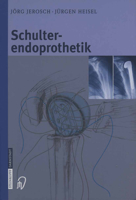 Schulterendoprothetik: Indikation, Implantate, OP-Technik, Nachbehandlung, Begutachtung 3798513309 Book Cover