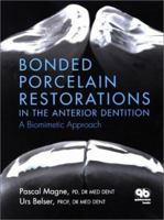 Bonded Porcelain Restorations in the Anterior Dentition: A Biomimetic Approach 0867154225 Book Cover