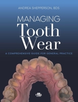 Managing Tooth Wear. A Comprehensive Guide For General Practice 1957260335 Book Cover