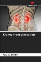Kidney transplantation 6202029803 Book Cover