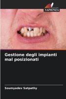 Gestione degli impianti mal posizionati (Italian Edition) 6208919215 Book Cover