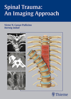 Spinal Trauma - An Imaging Approach 3131374713 Book Cover