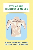 Vitiligo And The Story Of My Life: How To Find Your Calling And Live A Life Of Purpose: Vitiligo Social Stigma B092PKRPVY Book Cover