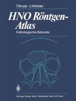 Hno Rontgen-Atlas: Pathologische Befunde 3642692427 Book Cover