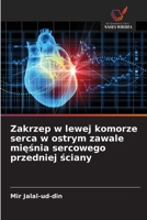 Zakrzep w lewej komorze serca w ostrym zawale mięśnia sercowego przedniej ściany 6136286319 Book Cover