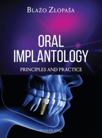 Oral Implantology: Principles and Practice 1967421471 Book Cover