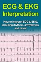 ECG & EKG Interpretation: How to interpret ECG & EKG, including rhythms, arrhythmias, and more! 1514813327 Book Cover