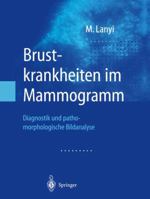 Brustkrankheiten im Mammogramm: Diagnostik und Pathomorphologische Bildanalyse 3662061783 Book Cover